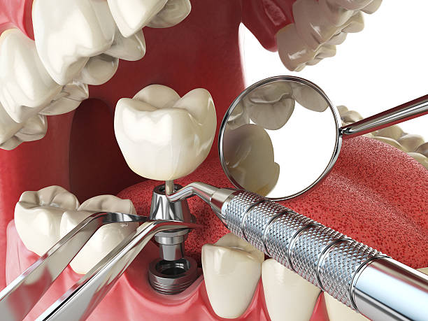 Best Emergency Dentist for Special Needs Patients in Herndon, VA